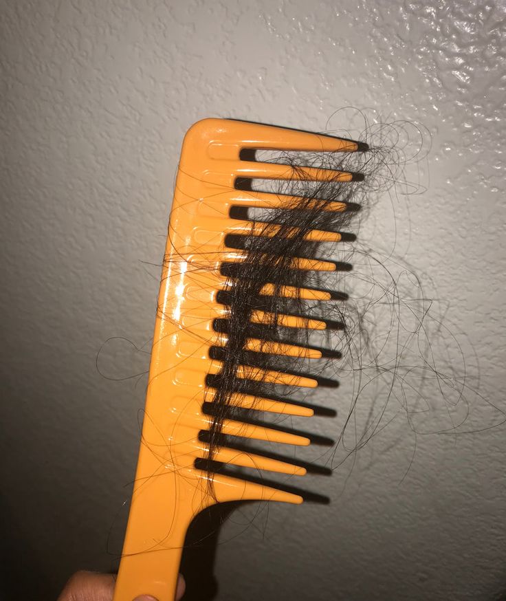 Hair Loss Treatment at KM Orgatonics – PRP, GFC & Hair Restoration in Gorakhpur