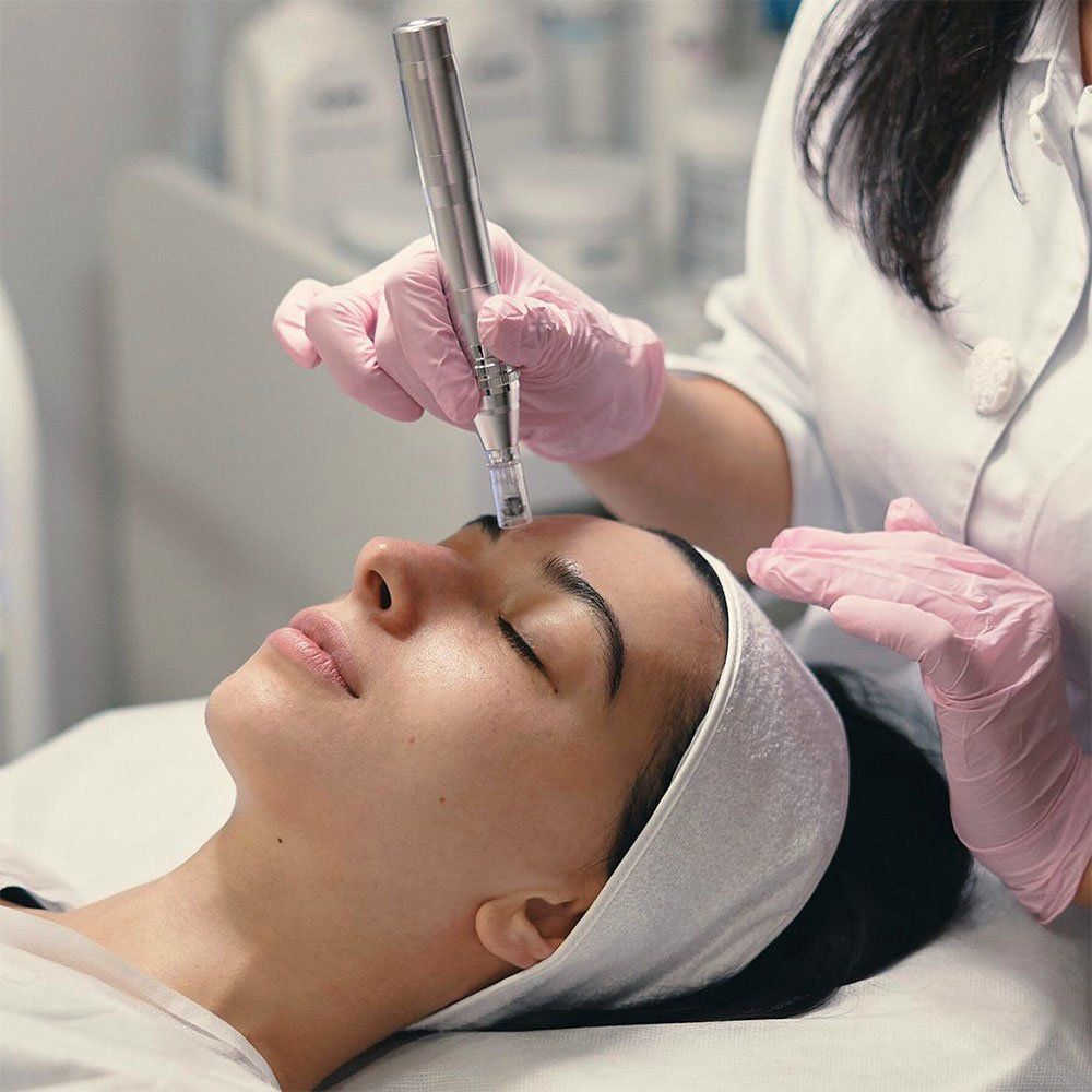 Client receiving a precise micro-needling treatment