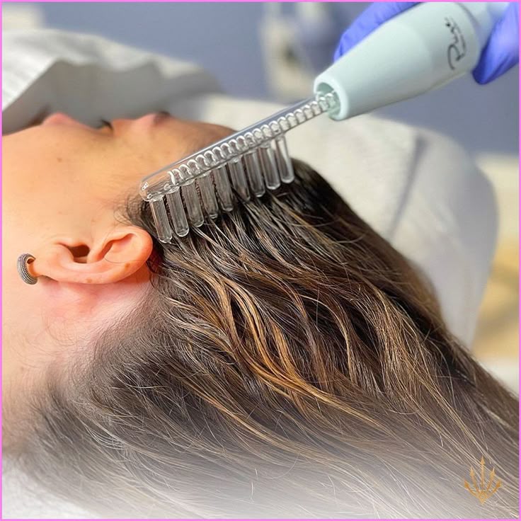 Autologous Hair Stem Cell Therapy Gorakhpur – Regrowth & Follicle Activation at KM Orgatonics