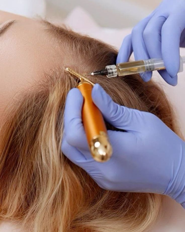 Autologous Hair Stem Cell Therapy at KM Orgatonics – Non-Surgical Hair Regrowth in Gorakhpur