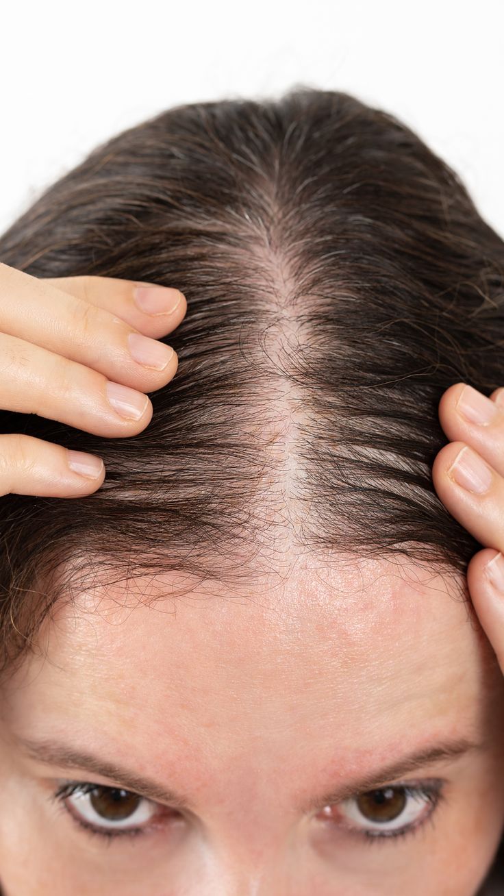 Hair Thinning & Density Boost Therapy at KM Orgatonics Gorakhpur – Visible Volume Results