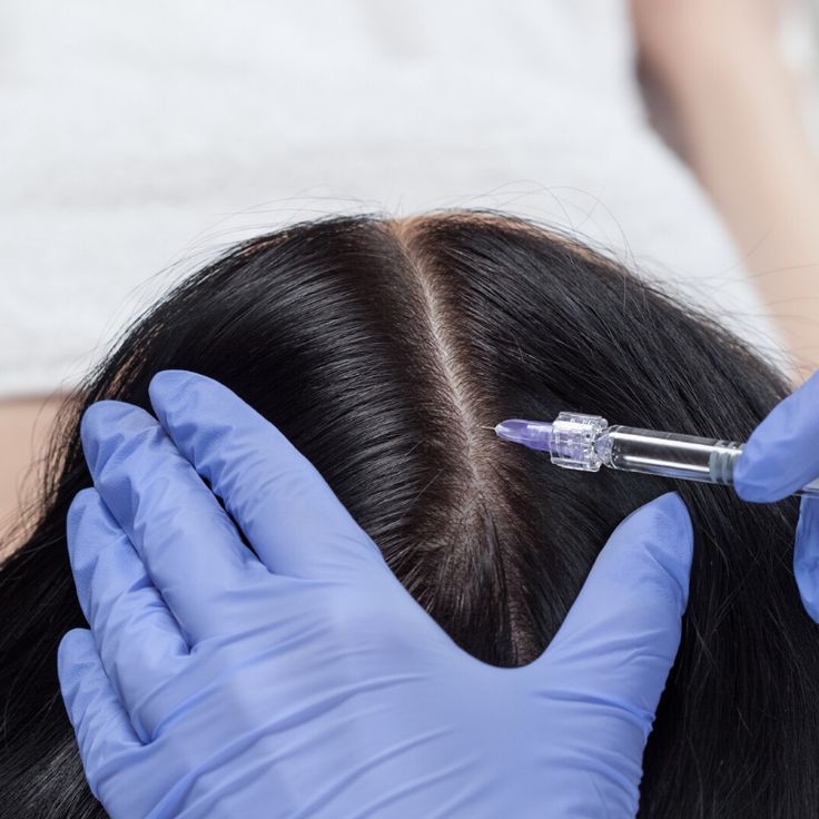 Ideal Candidates for PRP Hair Therapy at KM Orgatonics – Natural Hair Regrowth in Gorakhpur
