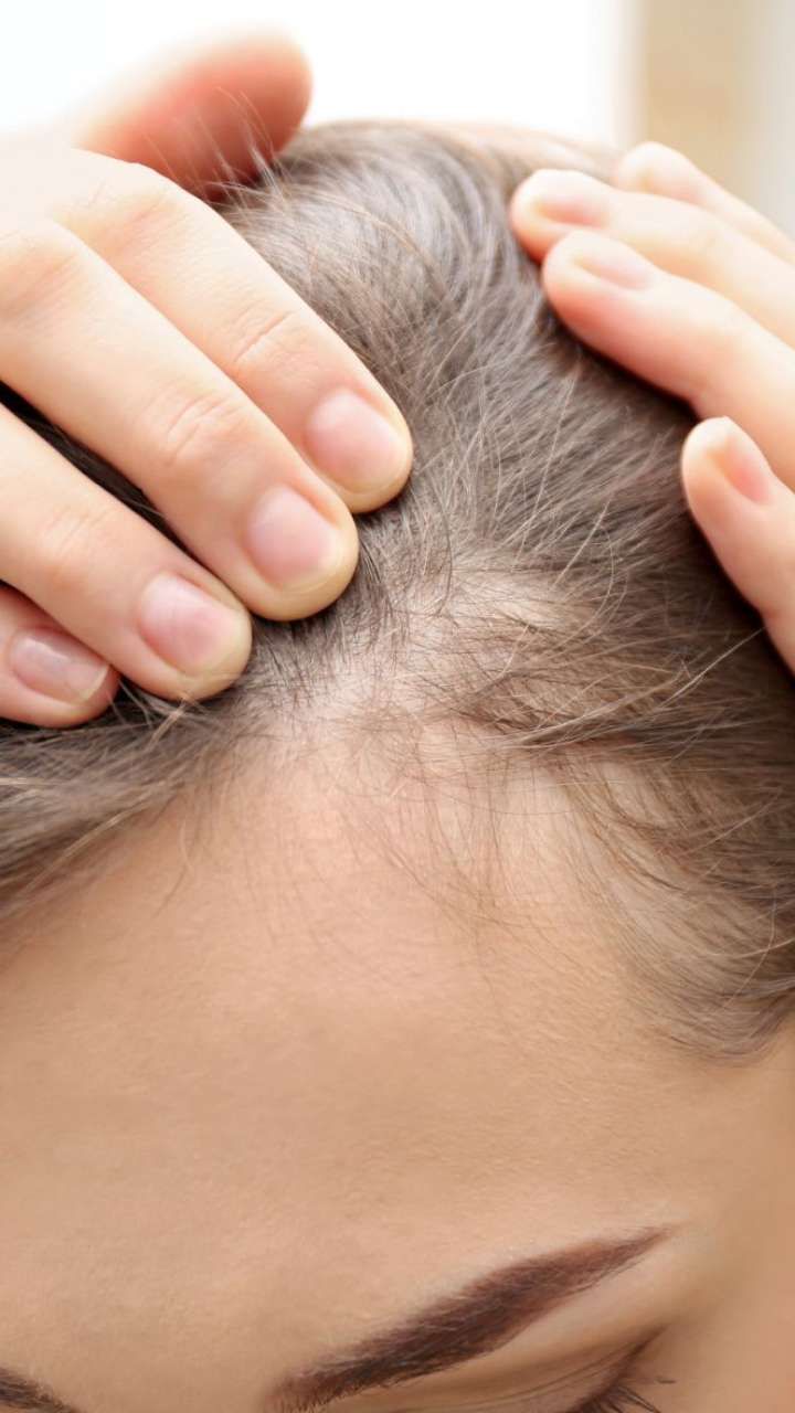Scalp Treatment Gorakhpur