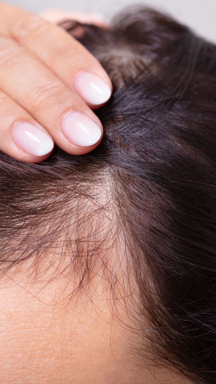 Scalp Detox Therapy KM Orgatonics – Hair Revitalization Results