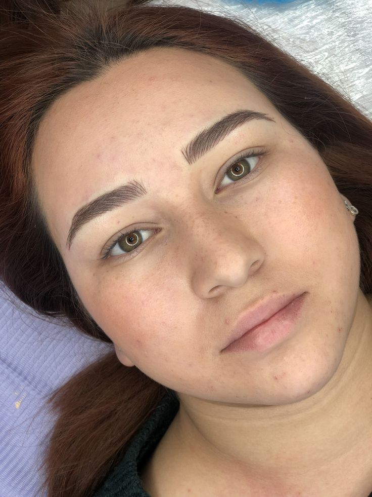 Brow Transformation - Brow Correction and Perfect Symmetry