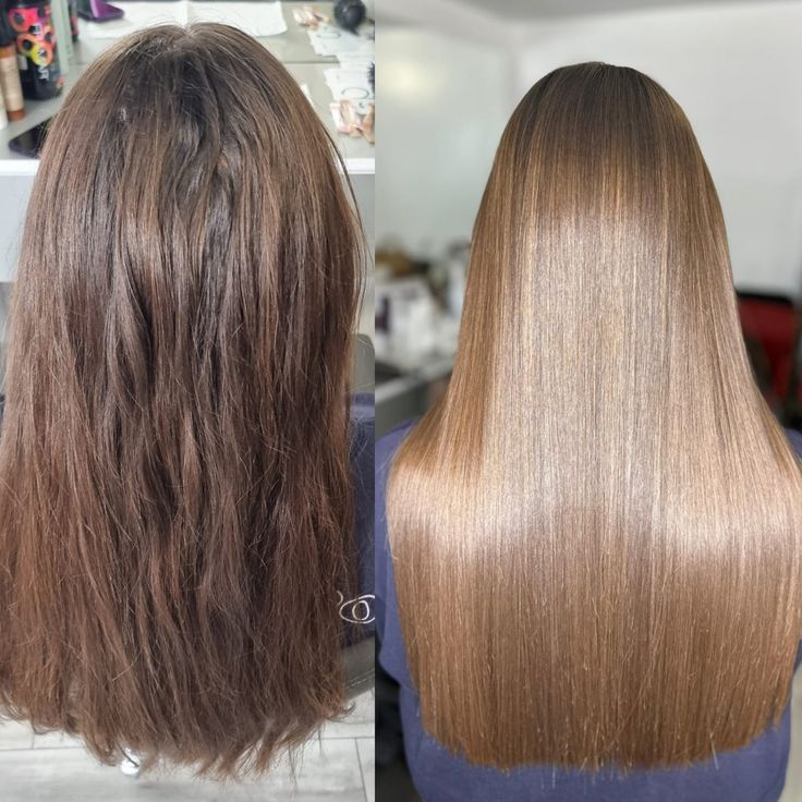 Nanoplastia Hair Transformation - Before & After 3